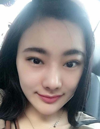 美萊案例劉雨婷對(duì)比圖后