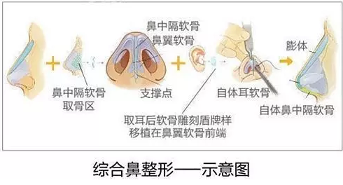 深圳美萊鼻綜合整形有哪些呢