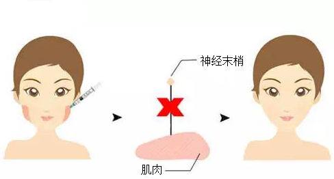 武漢美萊瘦臉需要注意事項有哪些