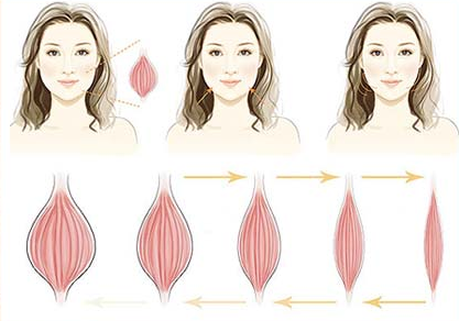 瘦臉注射后多久見(jiàn)效