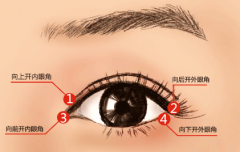 石家莊開眼角恢復時間內可帶眼鏡嗎