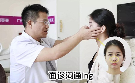 換對鼻子宛如換了一張臉