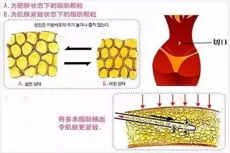 四月不吸脂，五、六、七月徒傷悲......