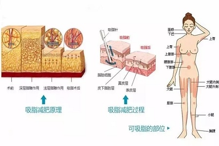 四月不吸脂，五、六、七月徒傷悲......