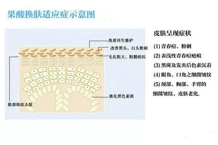 擠痘竟然被送進(jìn)ICU！你的痘痘還好嗎？