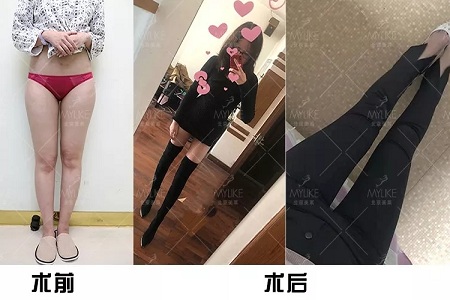 顏值：金剛如何化身長腿女神？