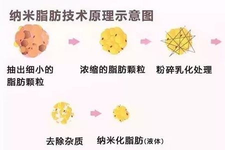 拿什么拯救你，我的黑眼圈？