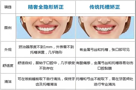 這種牙齒矯正方式，96%的人都會選擇！