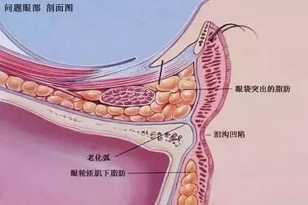 顯老淚溝，你還要任其放肆嗎？