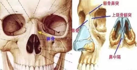 側(cè)面看鼻梁不矮,正面看鼻子卻很塌是什么原因？