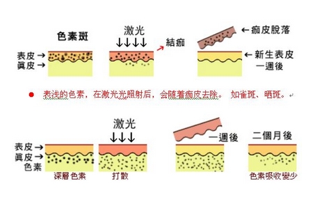 祛斑方法有哪幾種？這些祛斑小妙招你需要掌握